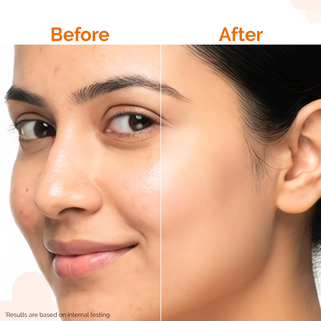 Pore Minimizing Sunscreen Gel For Open Pores & UVA/UVB Protection - 80g - Image 7