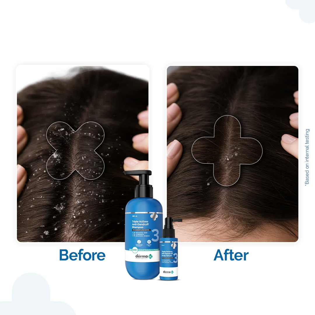 Triple Actives Anti-Dandruff Control Combo - Image 3